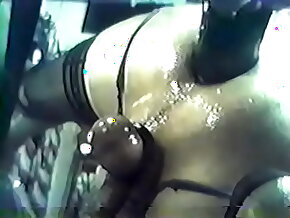 Extreme anal stretching